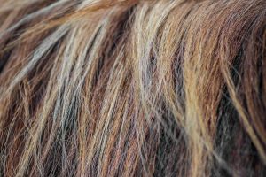 Budgeting For Hair Transplant Cost: An Overview
