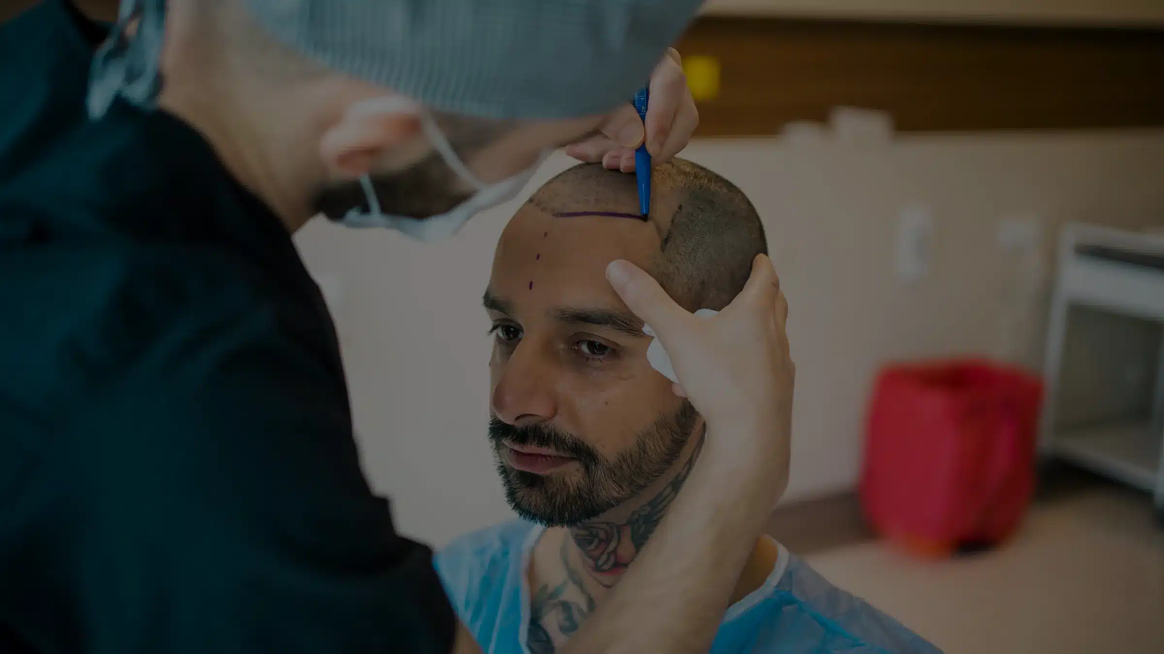 FUE vs FUT: Which Hair Transplant Method Is Recommended for You?