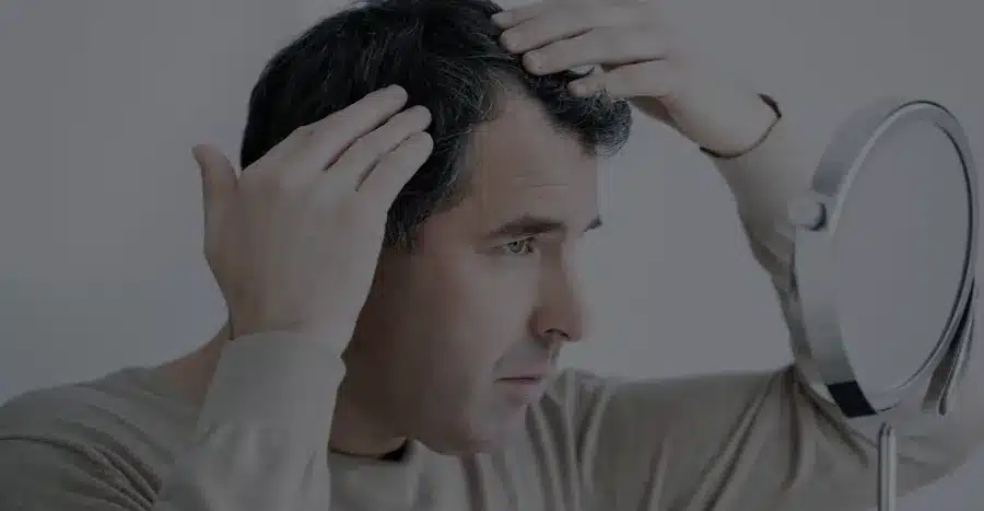 Questions to Ask Before Booking a Hair Transplant Near You